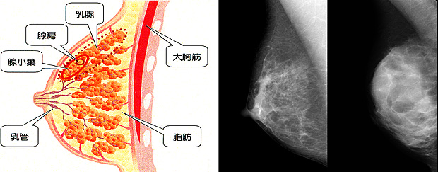 乳腺の構造の図と、乳腺の発達の程度を比較したレントゲン写真