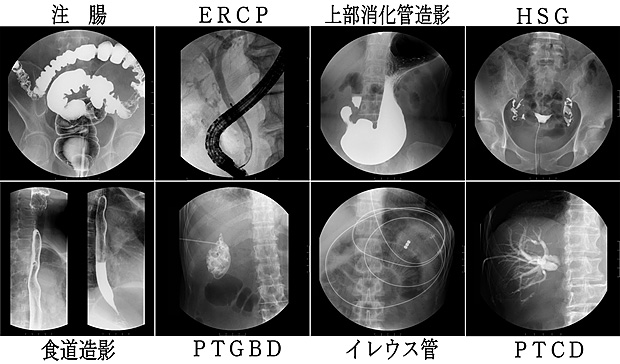 注腸、ERCP、上部消化管造影、HSG、食道造影、PTGBD、イレウス管、PTCD